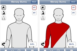 Mersey Burns iPhone health app