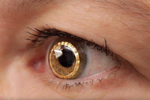 Sensimed contact lens sensor