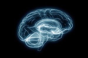 Alzheimers disease brain scan