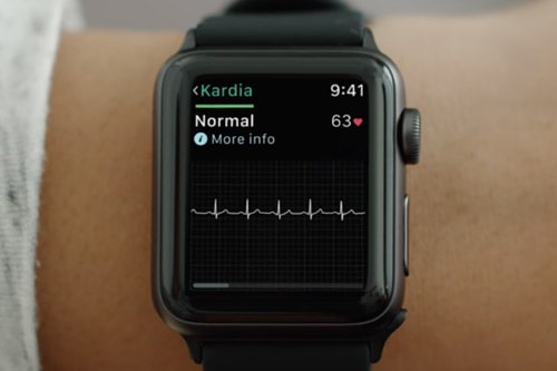 Apple Watch Kardia Band