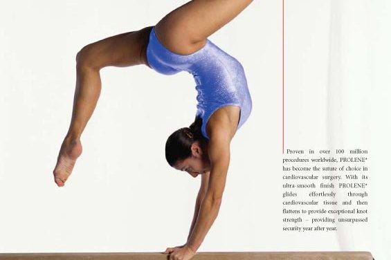 Prolene_gymnast on beam