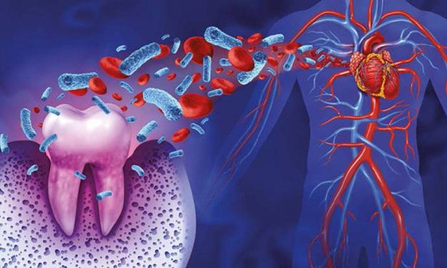 Oral health and systemic disease: why they may be more closely linked than we thought