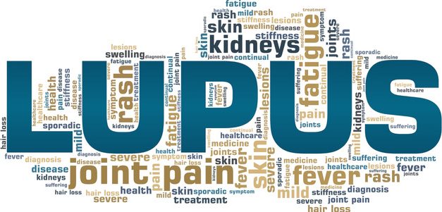 Lupus – moving patient care beyond current therapies towards resetting the immune system